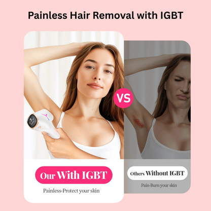 IPL Laser Hair Removal Device